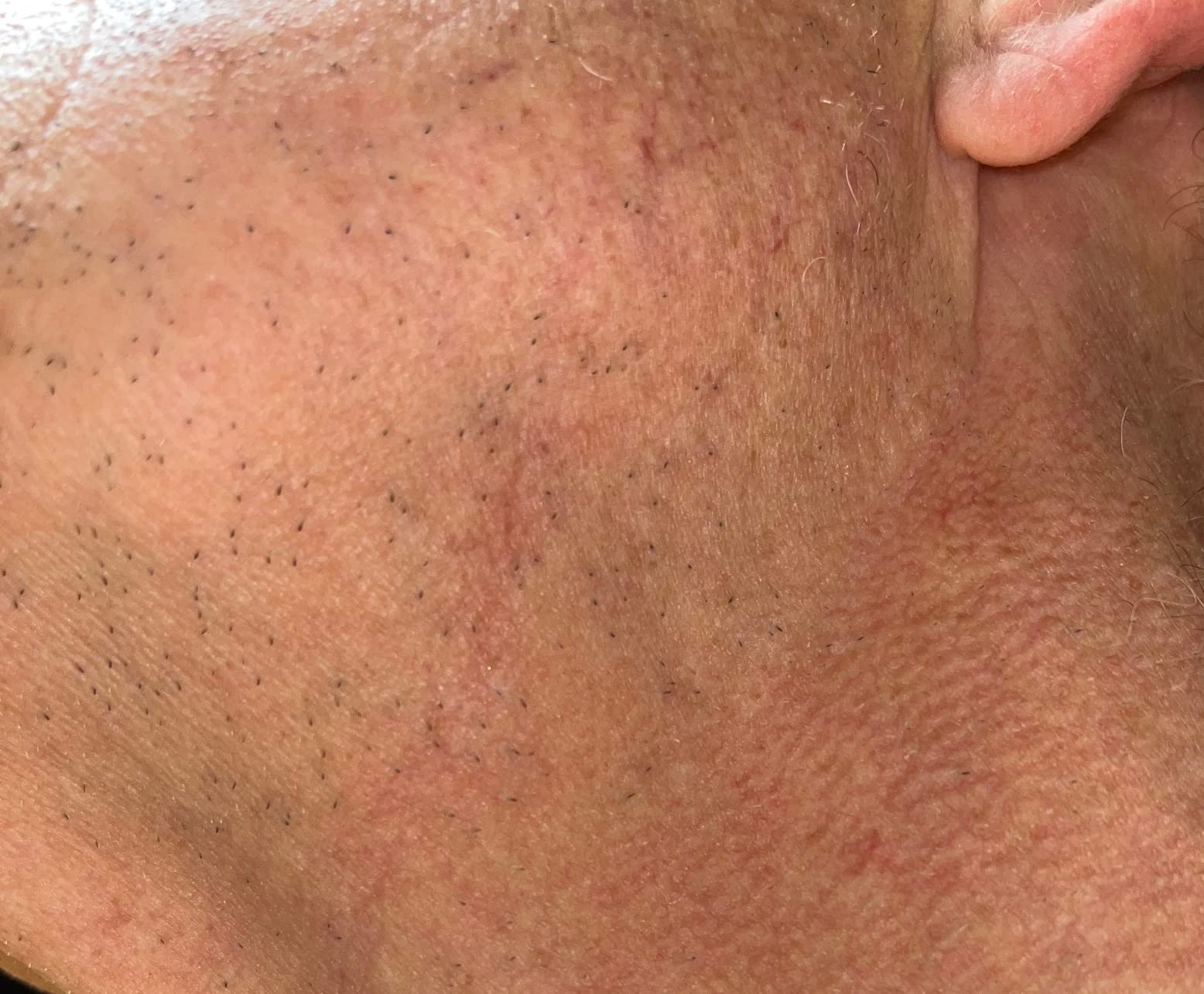 Braun Electric Series 3 Razor with Precision Trimmer, Rechargeable, Wet & Dry Foil Shaver for Men, 45 Minute Runtime, MicroComb and Long Hair Trimmer customer photo 2