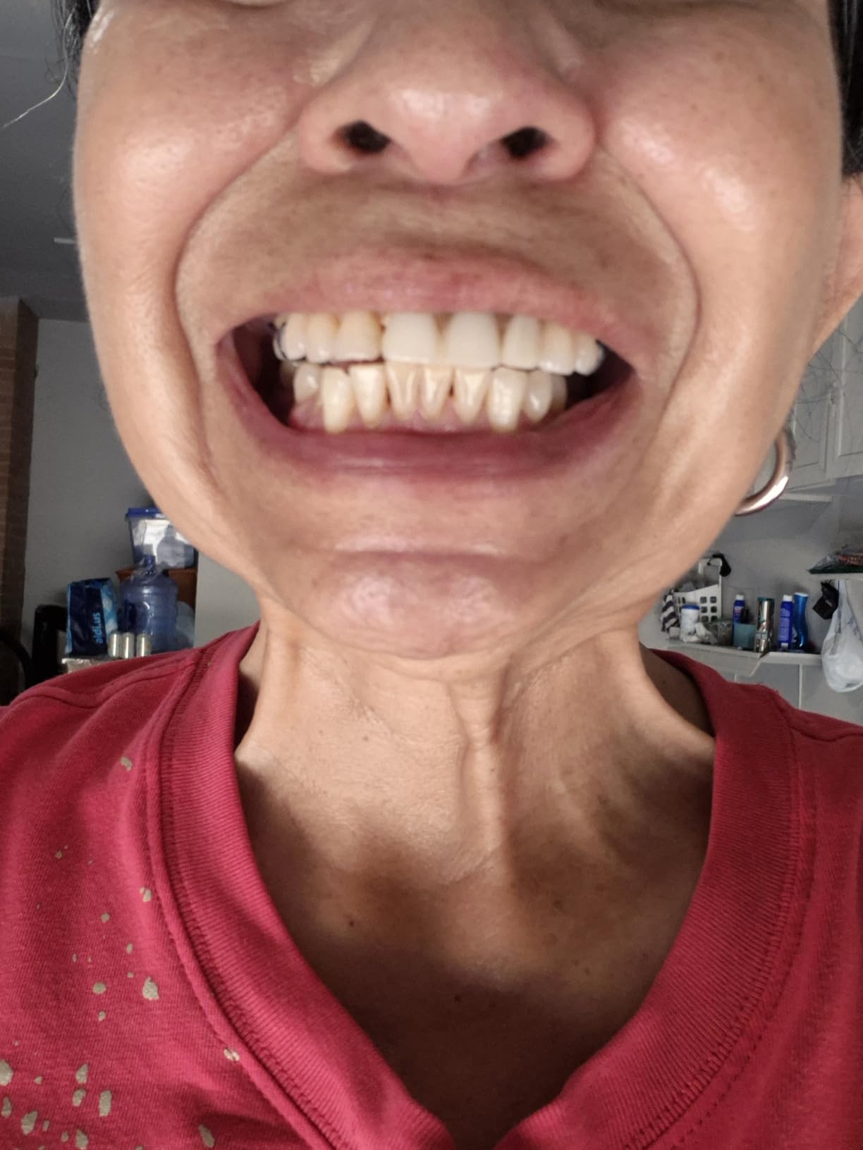 Crest 3D Whitestrips Professional Effects + LED Light - Teeth Whitening Kit, 1 Light + 20 Treatments, 40 Strips customer photo 1