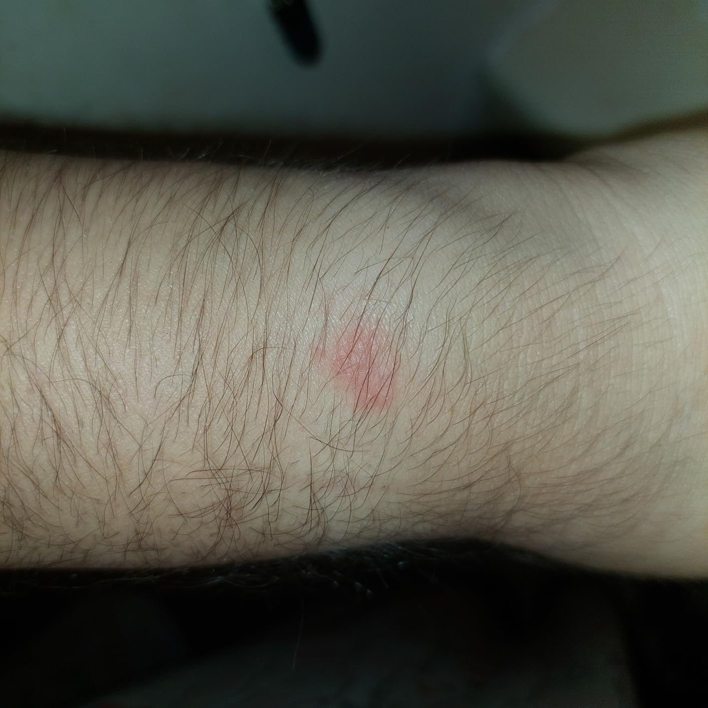 Fitbit Charge 6 customer photo 2