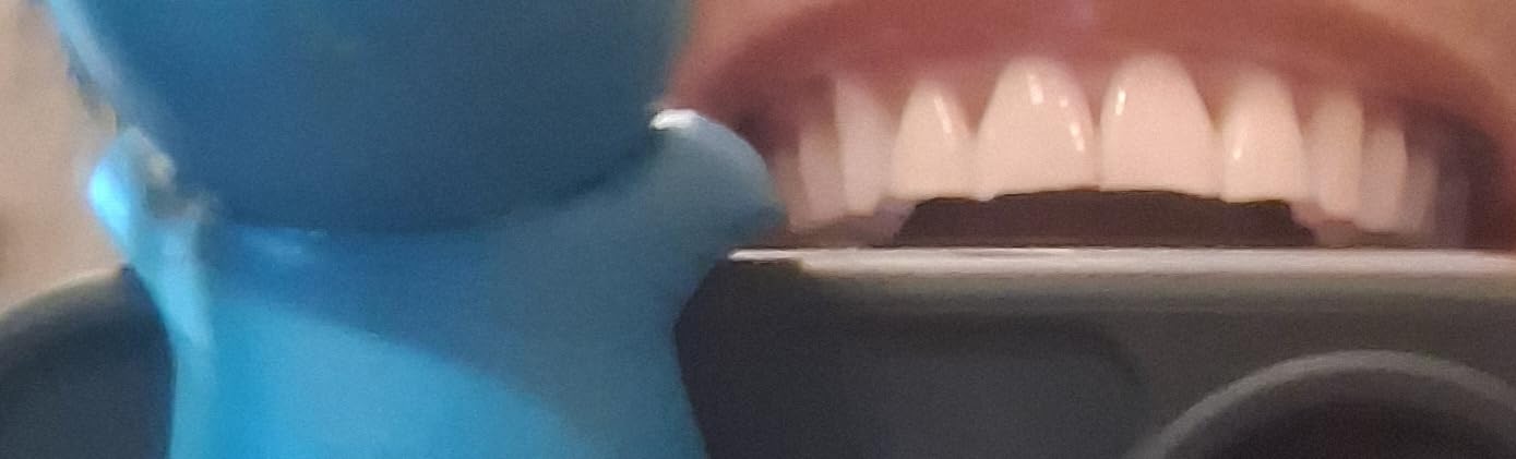 Crest 3D Whitestrips Sensitive & Gentle + LED Light Teeth Whitening Kit, 1 Light + 14 Treatments, 28 Strips customer photo 2