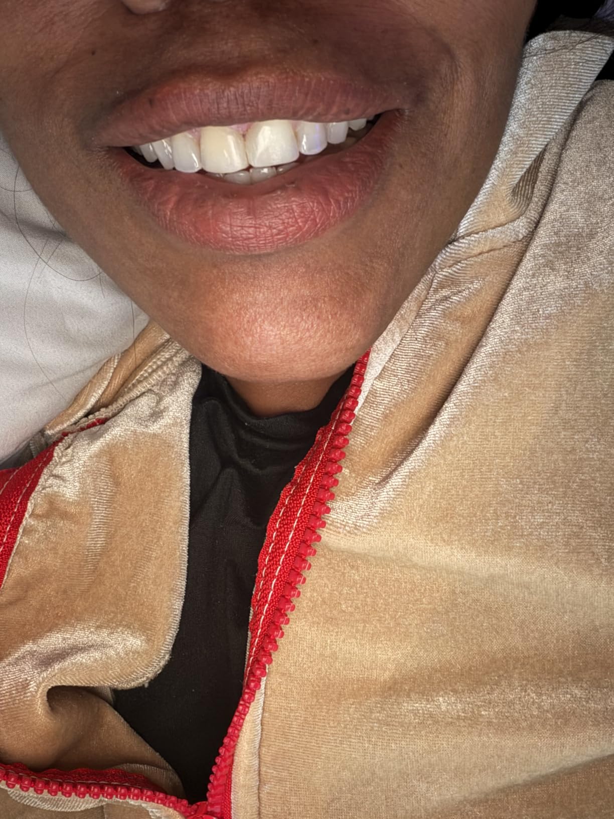 GuruNanda Teeth Whitening Kit, Up to 10 Shades Whitening, 40 Treatments | Wireless LED Accelerator Teeth Whitener with 8% Hydrogen Peroxide Teeth Whitening Gel Pen & Teeth Whitening Strips customer photo 1