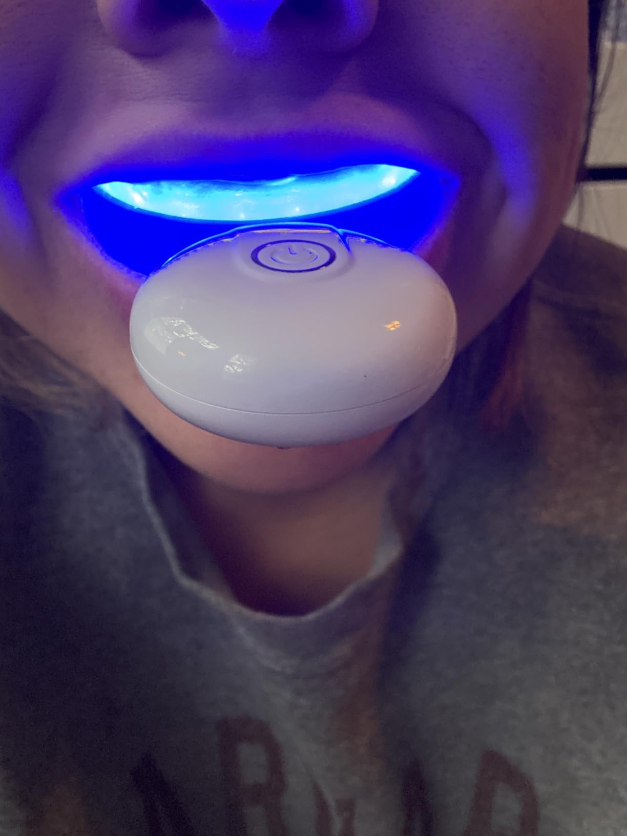 GuruNanda Teeth Whitening Kit, Up to 10 Shades Whitening, 40 Treatments | Wireless LED Accelerator Teeth Whitener with 8% Hydrogen Peroxide Teeth Whitening Gel Pen & Teeth Whitening Strips customer photo 2
