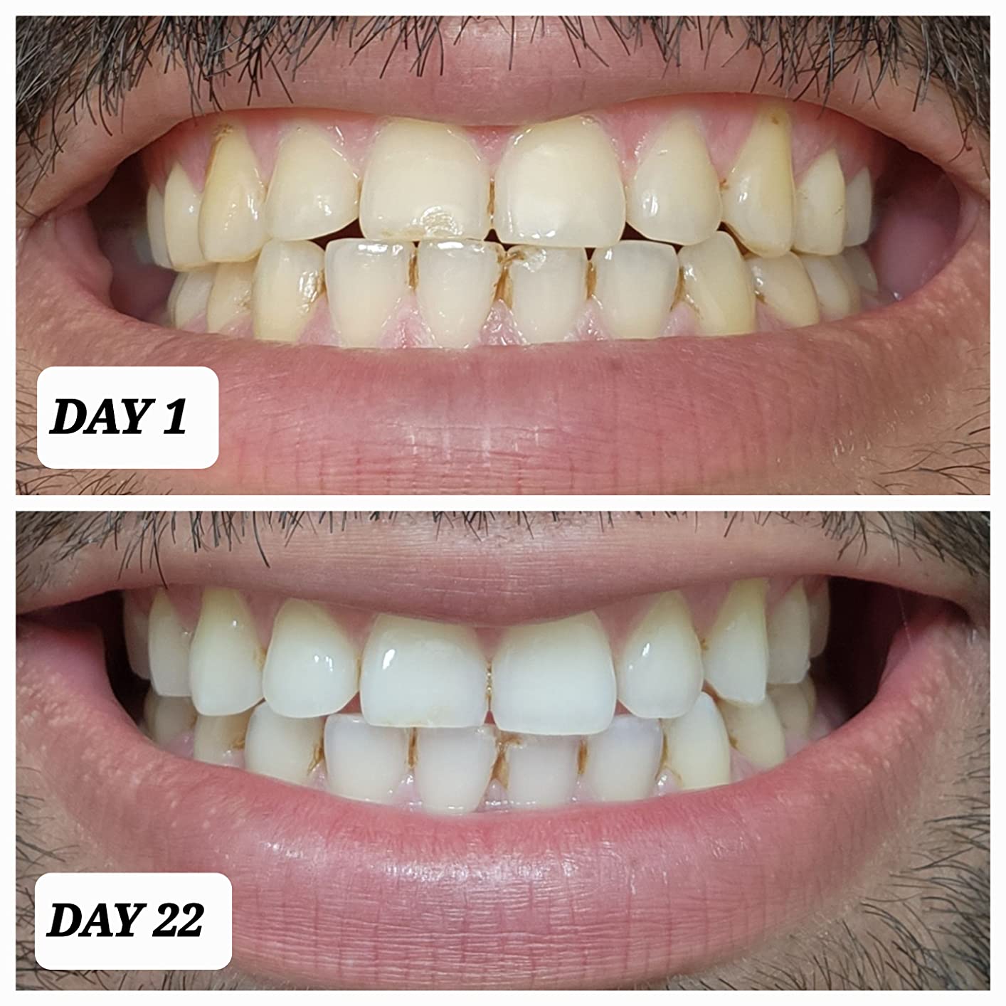 Crest Teeth Whitening Strips, Crest 3D Whitestrips Professional Effects, Enamel Safe Teeth Whitening Kit, 22 Treatments (44 Strips), Professional-Level Whitening, 19 Levels Whiter customer photo 1