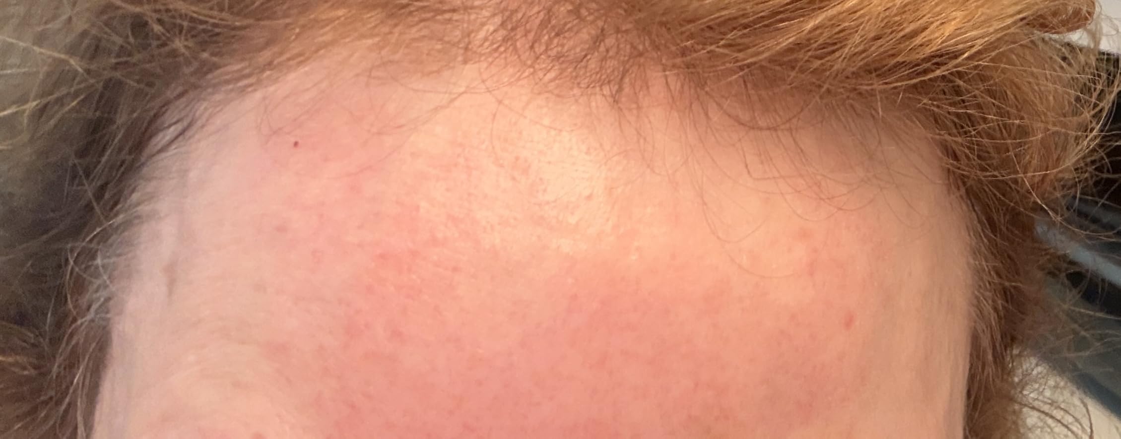The Ordinary Hyaluronic Acid 2% + B5 (with Ceramides), Multi-Depth Hydration Serum for Plumper, Smoother Skin customer photo 1